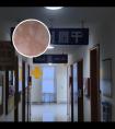 打完308激光以后过敏怎么办
