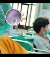 西格玛308光疗仪效果怎么样知乎
